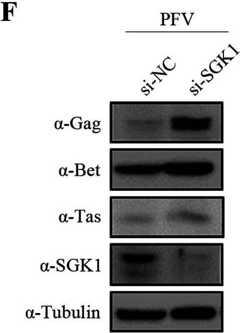 SGK1 inhibits PFV replication. (A to C) HT1080-Control and HT1080 stable expression cells (1 × 105) were infected with PFV (MOI = 0.6). At 48 h postinfection, 600 μL of the supernatants (A) or 1/10 infected HT1080 cell lines (B) were incubated with PFVL cells (1 × 105), the luciferase activity was measured 48 h later, and the rest of the infected cells were lysed for Western blotting (C). (D to F) HT1080-siControl and HT1080-siSGK1 cells (1 × 105) were infected with PFV (MOI = 0.6). At 24 h postinfection, 600 μL of the supernatants (D) or 1/10 infected HT1080 cells (E) were incubated with PFVL cells (1 × 105), and the luciferase activity was measured 48 h later. (F) The rest of the infected cells were lysed for Western blotting. (G to I) PFV (MOI = 0.6) infected Control and sg3 cell lines (1 × 105). At 48 h postinfection, 600 μL of the supernatants (G) or 1/10 infected HT1080 cells (H) were incubated with PFVL cells (1 × 105), and the luciferase activity was measured 48 h later. (I) The remaining infected cells were lysed for Western blotting. Data are expressed as the means ± standard deviations. Data are representative of three independent experiments. One-way ANOVA was used to perform the statistical test. *, P < 0.05; **, P < 0.01; ***, P < 0.001. Image collected and cropped by CiteAb from the following open publication (//pubmed.ncbi.nlm.nih.gov/35438526), licensed under a CC-BY license. Not internally tested by R&D Systems.