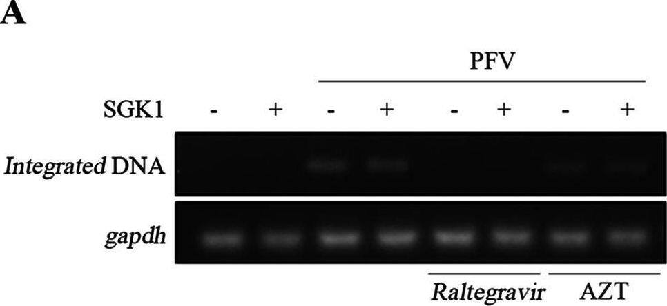 SGK1 inhibits PFV replication. (A to C) HT1080-Control and HT1080 stable expression cells (1 × 105) were infected with PFV (MOI = 0.6). At 48 h postinfection, 600 μL of the supernatants (A) or 1/10 infected HT1080 cell lines (B) were incubated with PFVL cells (1 × 105), the luciferase activity was measured 48 h later, and the rest of the infected cells were lysed for Western blotting (C). (D to F) HT1080-siControl and HT1080-siSGK1 cells (1 × 105) were infected with PFV (MOI = 0.6). At 24 h postinfection, 600 μL of the supernatants (D) or 1/10 infected HT1080 cells (E) were incubated with PFVL cells (1 × 105), and the luciferase activity was measured 48 h later. (F) The rest of the infected cells were lysed for Western blotting. (G to I) PFV (MOI = 0.6) infected Control and sg3 cell lines (1 × 105). At 48 h postinfection, 600 μL of the supernatants (G) or 1/10 infected HT1080 cells (H) were incubated with PFVL cells (1 × 105), and the luciferase activity was measured 48 h later. (I) The remaining infected cells were lysed for Western blotting. Data are expressed as the means ± standard deviations. Data are representative of three independent experiments. One-way ANOVA was used to perform the statistical test. *, P  0.05. Image collected and cropped by CiteAb from the following open publication (//pubmed.ncbi.nlm.nih.gov/35438526), licensed under a CC-BY license. Not internally tested by R&D Systems.