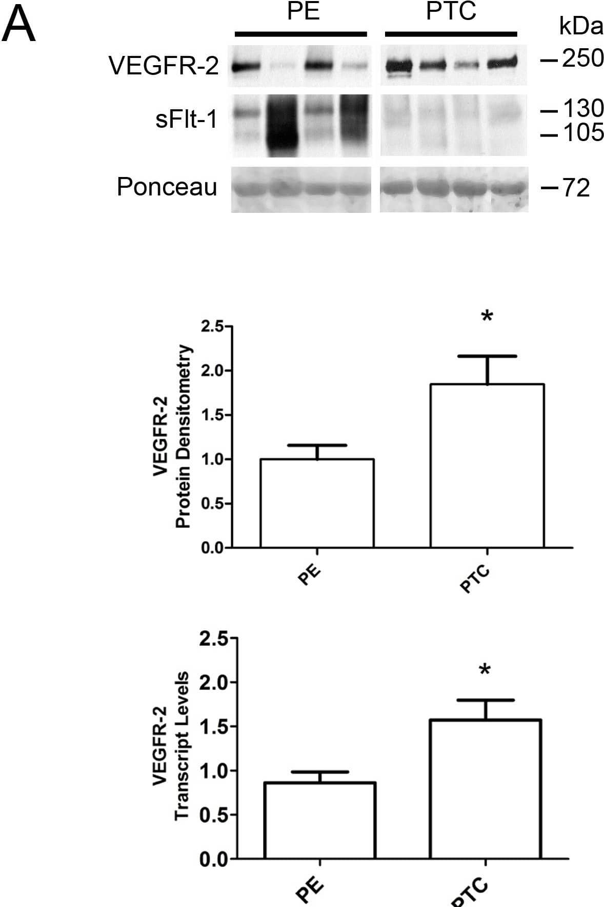 An inverse correlation between VEGFR-2 and sFlt-1 levels in preeclamptic placentae.A: Representative VEGFR-2 and sFlt-1 immunoblots of PE and PTC placentae. Densitometry analysis comparing normalized VEGFR-2 immunoreactivity between PE (n = 13) and PTC (n = 8) samples. VEGFR-2 transcript levels were assessed by qPCR analysis comparing PE (n = 12) and PTC (n = 7) samples. B: Representative VEGFR-2 and sFlt-1 immunoblots of placental tissues from PE and control (Con) dichorionic twins. (PE, preeclampsia; PTC, age-matched preterm control; *P<0.05). All values are represented as the means±SEM. Image collected and cropped by CiteAb from the following open publication (//pubmed.ncbi.nlm.nih.gov/24260556), licensed under a CC-BY license. Not internally tested by R&D Systems.