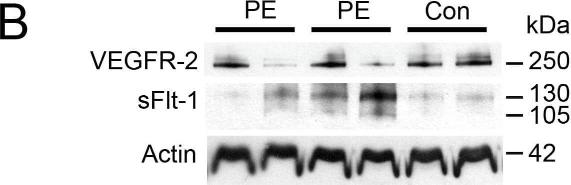 An inverse correlation between VEGFR-2 and sFlt-1 levels in preeclamptic placentae.A: Representative VEGFR-2 and sFlt-1 immunoblots of PE and PTC placentae. Densitometry analysis comparing normalized VEGFR-2 immunoreactivity between PE (n = 13) and PTC (n = 8) samples. VEGFR-2 transcript levels were assessed by qPCR analysis comparing PE (n = 12) and PTC (n = 7) samples. B: Representative VEGFR-2 and sFlt-1 immunoblots of placental tissues from PE and control (Con) dichorionic twins. (PE, preeclampsia; PTC, age-matched preterm control; *P<0.05). All values are represented as the means±SEM. Image collected and cropped by CiteAb from the following open publication (//pubmed.ncbi.nlm.nih.gov/24260556), licensed under a CC-BY license. Not internally tested by R&D Systems.