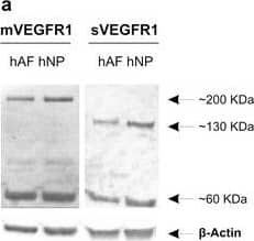 VEGFR1 isoforms in human degenerated and bovine healthy discs. A representative immunoblotting assay showed the expression of the full-length membrane form (~ 200 kDa), the soluble form (~ 130 kDa) and a cytoplasmic fragment (~ 60 kDa) in human degenerated (a) and healthy bovine (c) disc cells.  beta -Actin was used as control. Western blot quantification of membrane and soluble VEGFR1 was performed on human (b; n = 3) and bovine (d; n = 2) disc cells. Results represent an average of area (square pixels) ± SD normalized on  beta Actin. White bars represent AF, grey bars NP. No statistical significance with non-parametric Mann–Whitney–Wilcoxon U test for independent variables Image collected and cropped by CiteAb from the following open publication (//pubmed.ncbi.nlm.nih.gov/29784013), licensed under a CC-BY license. Not internally tested by R&D Systems.