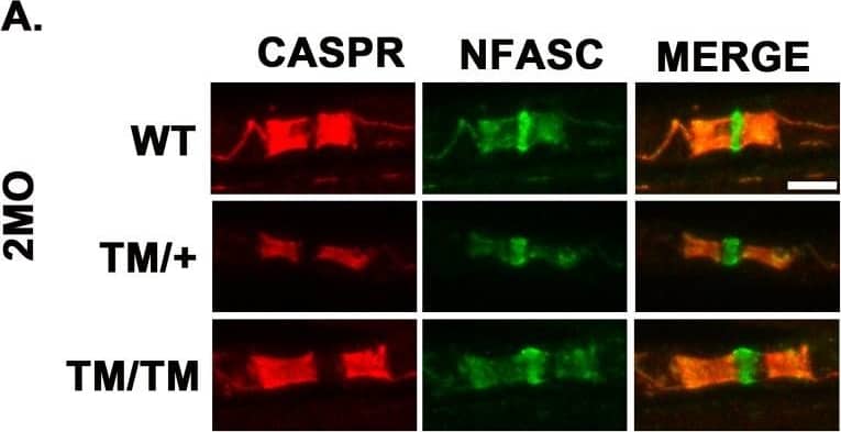 P0T124M mutation alters nodes and paranodes.Representative confocal pictures of sciatic nerve teased fibers stained with antibodies against the paranodal marker CASPR (red) and the paranodal and nodal marker pan-Neurofascin (NFASC; green) at 2 (A) and 12 (E) months of age. Scale bars: 5 μm. CASPR length quantifications at 2 (B) and 12 (F) months of age. Nested one-way ANOVA [2 month old: F (2,9) = 7.009, p = 0.0146; 12 month old: F (2,7) = 35.47, p = 0.0002]. Relative frequency distributions of paranodal (CASPR) length at 2 (C) and 12 (G) months of age. Nodal length quantifications at 2 (D) and 12 (H) months of age. Nested one-way ANOVA [2 month old: F (2,9) = 1.122, p = 0.3671, 12 month old: F (2,7) = 8.012, p = 0.0155]. At least 200 paranodes and 100 nodes per genotype were quantified at each time point. n (animals) ≥ 3 per genotype. (I) Electron micrographs of ultrathin longitudinal WT and MpzT124M/T124M sciatic nerve section at 12 months of age. In (I) electron micrographs represent nodes of WT and MpzT124M/T124M sciatic nerves. (J) The quantification of nodal length shows significant widening of the node in MpzT124M/T124M. Magnifications of (I) show disorganized paranonal loops in MpzT124M/T124M but well organized in WT. n (animals) ≥ 3 per genotype, 7 to 11 nodes were counted per animals, for a total of 27 and 28 counted by genotype. Scale bare: top panel 1 μm, middle panel 500 nm, bottom panel 200 nm. ***p < 0.001 by multiple-comparisons Tukey’s post hoc tests after Nested one-way ANOVA (B, F, D, and H) or Nested two-tailed Student’s t test (J). Graphs indicate means ± SEMs. Image collected and cropped by CiteAb from the following open publication (//pubmed.ncbi.nlm.nih.gov/36350884), licensed under a CC-BY license. Not internally tested by R&D Systems.