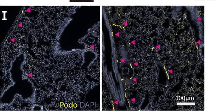 Carboplatin induces lymphangiogenesis in healthy tissues (A) Schematic of rat mesentery culture model. (B) Vehicle-treated lymphatic vessels from mesentery cultures stained with LYVE-1 (grey). (i) High magnification image of boxed area in (B). (C) Carboplatin-treated lymphatic vessels from mesentery cultures stained with LYVE-1 (grey). (ii) High magnification image of boxed area in (C) Scale bar=100µm. (D) Number of sprouts per lymphatic vessel area (n=3/group). (E) Lymphatic vessel density (podoplanin+ vessels per mm2 stroma) in whole mammary fat pads of healthy mice treated with systemic carboplatin (8 mg/kg/dose) or vehicle by IV(n=3-4/group). (F) Lymphatic vessel density measured in mammary fat pads of healthy mice 2 months after treatment with 3 doses of carboplatin or vehicle, (n=3/group). (G) Lymph nodes from healthy, tumor-naïve mice treated with vehicle and stained H&E. (H) LEC number in vehicle-treated and carboplatin-treated lymph nodes in vivo (n=6/group). (I) Representative images of lungs from mice treated with 3 doses of vehicle (left) and carboplatin (right). Podoplanin+ lymphatic vessels noted by arrowheads. (J) Lymphatic vessel density in stromal tissue of lungs of mice pre-treated with carboplatin (n=3/group). *p < 0.05, **p < 0.01, ****p < 0.001. Each data point represents one mouse. Image collected and cropped by CiteAb from the following publication (//pubmed.ncbi.nlm.nih.gov/35372032), licensed under a CC-BY license. Not internally tested by R&D Systems.