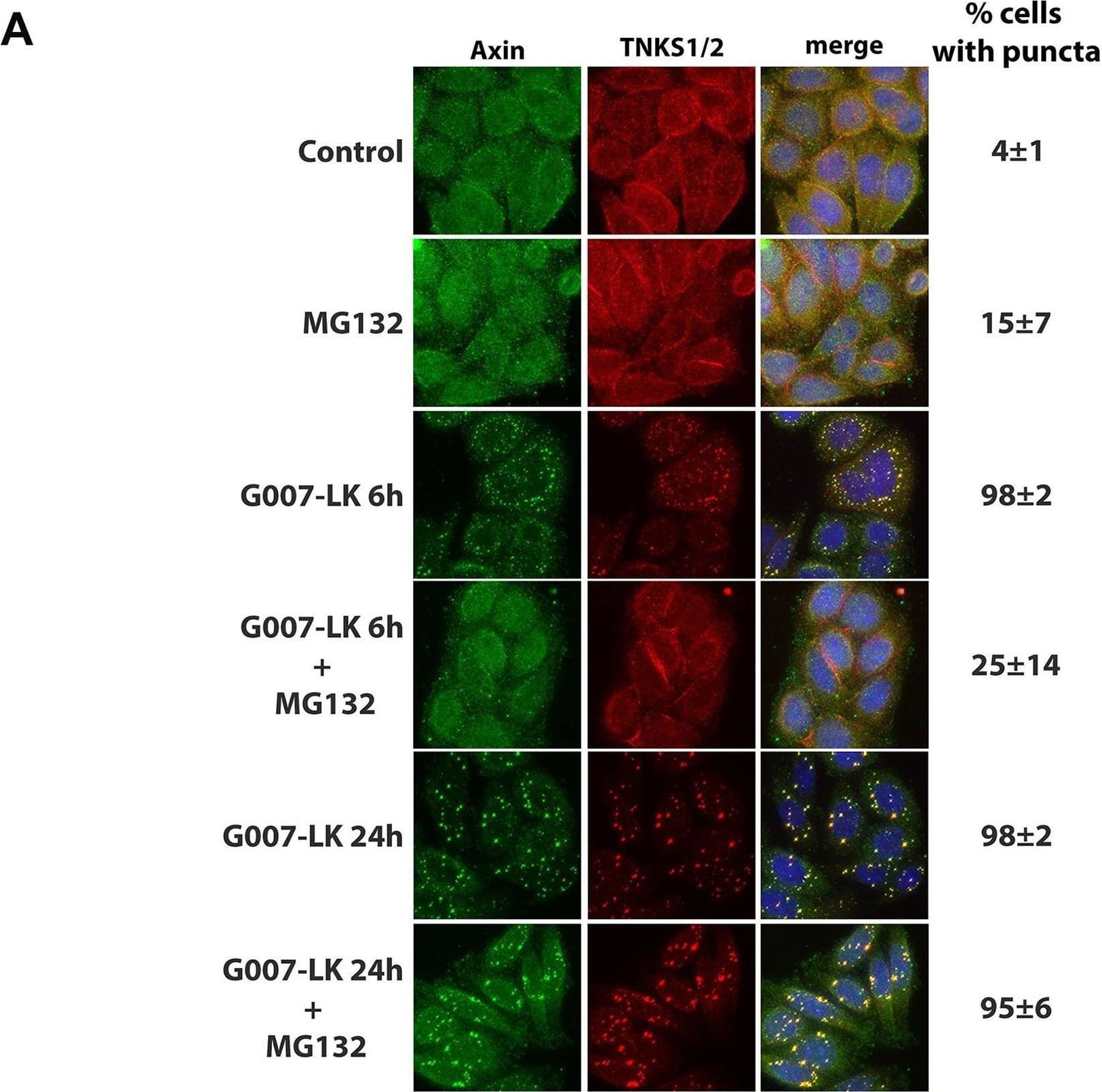 Induction of axin puncta by TNKSi is proteasome-dependent. A. SW480 cells were treated with single or combined doses of tankyrase (5 μM G007LK) and proteasome (20 μM MG132) inhibitors. The MG132 was added for 6 h, either simultaneously with G007-LK for a 6 h treatment, or during the last 6 h of a 24 h G007-LK treatment. As shown in the immunofluorescence images, the addition of MG132 caused a reduction in the % of cells with visible TNKSi-induced axin puncta after 6 h treatment. The 6 h MG132 treatment also caused a modest increase in nuclear staining of axin. The later addition of MG132 (at the end of a 24 h G007-LK treatment) caused the induced axin puncta to relocate to the perinuclear region. B. The number of axin puncta per cell were scored by microscopy and categorized (15 puncta per cell). As shown, TNKSi induced a high number of puncta per cell (more than 80% of cells scored >15 puncta per cell) and this was blocked at 6 h or reduced after 24 h by MG132 treatment. C. A diagram summarizing the effect of G007-LK +/- MG132 on axin pattern and cellular distribution (shown in green). Image collected and cropped by CiteAb from the following open publication (//pubmed.ncbi.nlm.nih.gov/26930278), licensed under a CC-BY license. Not internally tested by R&D Systems.