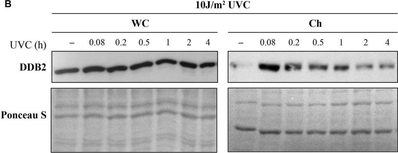 Ultraviolet radiation irradiation induces the DDB2 ubiquitination and degradation. The GMU6 cells were globally irradiated with UVC at 30 (A) or 10 J/m2(B), and fractionated at the indicated time. The whole cell extracts and chromatin-bound protein fractions were separated on SDS-PAGE and immunoblotted for DDB2. Where specified in panel (B), 10 μM of the proteasome inhibitor MG132 was added 1 h before irradiation with 10 J/m2 UVC to show that the time-dependent depletion of DDB2 in Ch fraction is a result of proteasomal degradation of PTM-modified DDB2. Ponceau S staining was used as loading control. Image collected and cropped by CiteAb from the following open publication (//pubmed.ncbi.nlm.nih.gov/33282869), licensed under a CC-BY license. Not internally tested by R&D Systems.