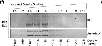 Western Blot CD117/c-kit Antibody [Unconjugated]