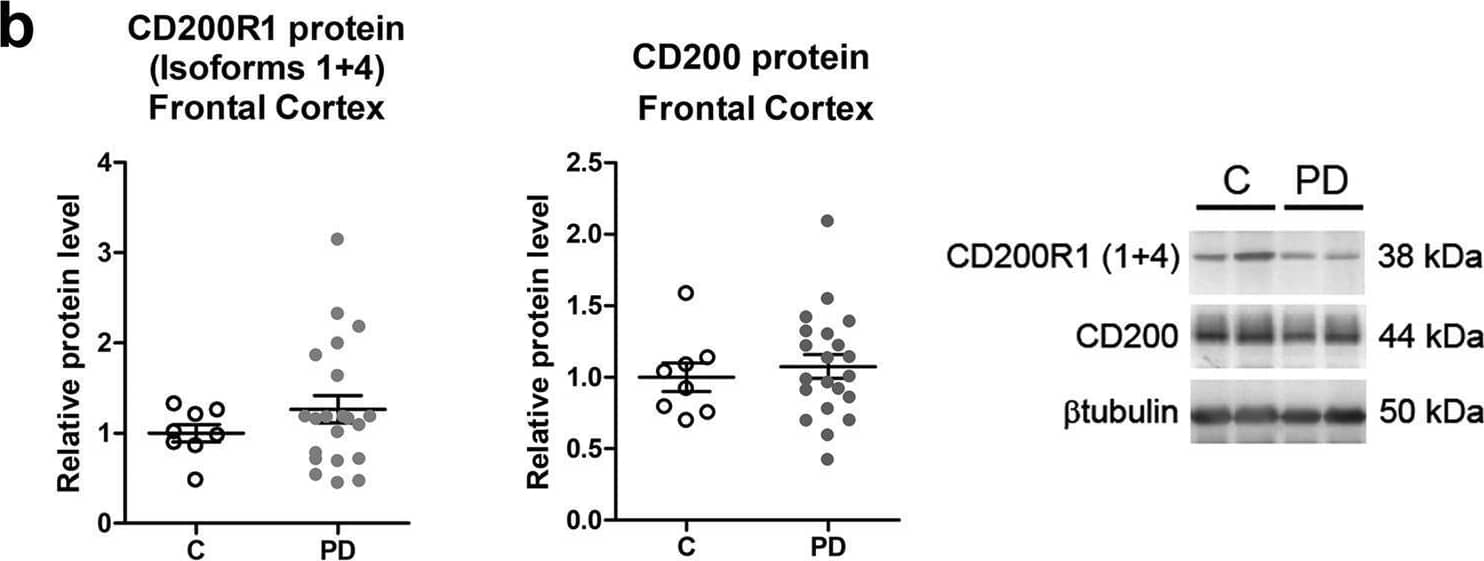 CD200R1 and CD200 protein levels in the post-mortem brain of Parkinson’s disease patients. Expression of CD200R1 protein isoforms 1 and 4 and CD200 proteins in the substantia nigra (SN) (a), frontal cortex (b), and hippocampus (c) tissue homogenates from control individuals (C, n = 4–8) and Parkinson’s disease patients (PD, n = 11–21) by western blot. Representative immunoblots are presented. Protein levels were normalized relative to  beta tubulin. Data are expressed as fold change relative to C and are depicted as individual points with bars showing means ± SEM. *p < 0.05 and **p < 0.01 vs. C; Mann-Whitney test. Image collected and cropped by CiteAb from the following open publication (//pubmed.ncbi.nlm.nih.gov/35296683), licensed under a CC-BY license. Not internally tested by R&D Systems.