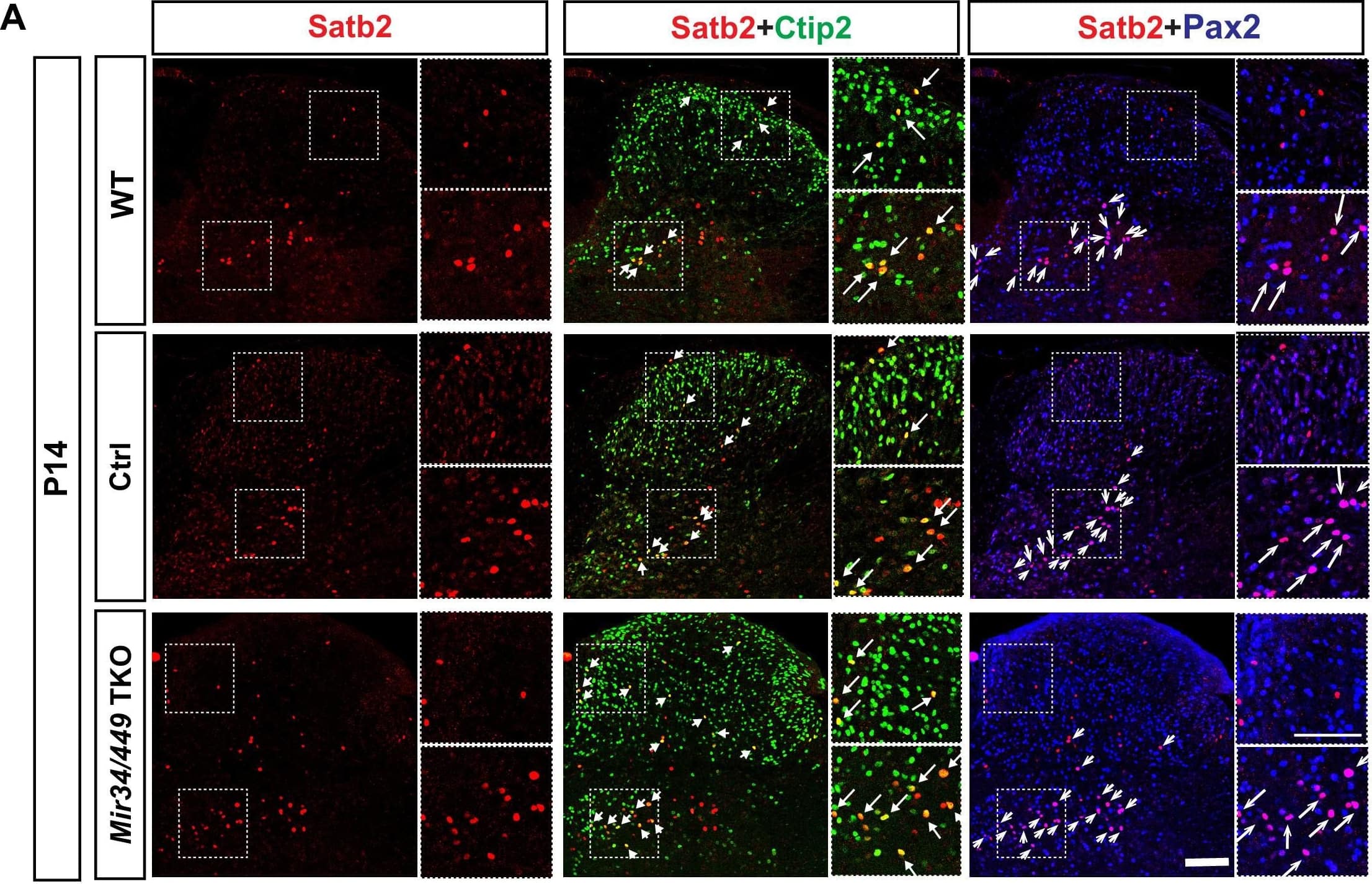 MiR34/449 tunes optimal Satb2 expression in the Ctip2 IN subpopulation.(A) Immunostaining for Satb2, Ctip2,&Pax2 in dorsal&intermediate spinal cord at P14. Note that Satb2on INs display two molecular identities, i.e., the Ctip2on or Pax2on subpopulations. Comparison with WT/Ctrl reveals an increase in the cell number of Satb2on;Ctip2on INs in the intermediate spinal cord of cervical/brachial sections upon MiR34/449 deletion. Boxed areas indicate higher magnification regions from the intermediate&dorsal regions of each image. Arrows highlight the presence of dual-labeled Satb2on;Ctip2on cells (yellow) or dual-labeled Satb2on;Pax2on cells (magenta) among the Satb2on population. (B–C) Quantifications of cell number from (A). (D) Quantifications of the Satb2on;Ctip2on&Satb2on;Pax2on subpopulations normalized against total Satb2on cell numbers&are shown as a %age. (E) Comparison of the spatial distribution of individual Satb2on;Ctip2on INs in the cervical/brachial spinal cord of indicated mice (Ctrl, grey; Mir34bc/449 DKO&Mir34/449 TKO, magenta). Frequency distributions along the medio-lateral (top)&dorso-ventral (right) axes represent non-linear regressions. (F) A contour density plot of Satb2on;Ctip2on INs indicates that Satb2on;Ctip2on INs are mainly located in the medial spinal cord of both MiR34/449 mutant&Ctrl mice. Contour lines represent density at the 30th–90th %iles. Data analyzed from more than 25 sections of at least five independent spinal cords in (E)&(F). (G) Schematic illustrating the increased number of Satb2on;Ctip2on INs in the MiR34/449 mutant spinal cord. Data are presented as mean ± SD. One-way ANOVA with Tukey’s multiple comparisons test. * denotes p<0.05; ‘NS’ denotes ‘not significant’. Scale bars represent 100 μm. Image collected&cropped by CiteAb from the following open publication (//pubmed.ncbi.nlm.nih.gov/33787491), licensed under a CC-BY license. Not internally tested by R&D Systems.