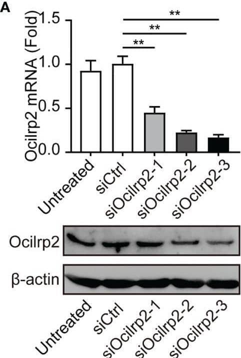 Silencing of Ocilrp2 promotes IL-6 expression in vitro and in vivo. (A) Peritoneal macrophages were transfected with scrambled siRNA (siCtrl) or three Ocilrp2 siRNAs (siOcilrp2-1, siOcilrp2-2, siOcilrp2-3) for 48 h, Ocilrp2 mRNA levels were detected with qRT-PCR, and Ocilrp2 protein levels were analyzed by Western Blot. The experiment was repeated three times. (B) qRT-PCR analysis of Ocilrp2 mRNA level in mouse peritoneal macrophages transfected with Ocilrp2 siRNA and 48 h later stimulated with LPS or infected with VSV for the indicated time.(C) qRT-PCR analysis of IL-6 mRNA level in macrophages transfected as in (A), and 48 h later stimulated with LPS for the indicated time and (D) ELISA of IL-6 in supernatants of macrophages stimulated with LPS for 8 h. (E) qRT-PCR analysis of IL-6 mRNA level in macrophages transfected as in (A), and 48 h later after VSV infection for the indicated time. (F) ELISA of IL-6 in supernatants of macrophages transfected as in (A), and 48 h later infection with VSV for 8 h. (G, H) Six C57BL/6 mice were transfected in vivo with Ocilrp2 siRNA or Control siRNA (2.5 mg/kg) for 2 days, respectively. Then, peritoneal macrophages and serum were collected at 12 h after intraperitoneal injection of LPS (10 mg/kg). qRT-PCR analysis of Ocilrp2 and IL-6 mRNA level in mouse peritoneal macrophages and (I) ELISA of IL-6 in serum. Data were calculated from at least 3 independent experiments (means ± s.e.m.), *P< 0.05, **P< 0.01 (The two-tailed Student’s t-test). Image collected and cropped by CiteAb from the following open publication (//pubmed.ncbi.nlm.nih.gov/36300111), licensed under a CC-BY license. Not internally tested by R&D Systems.