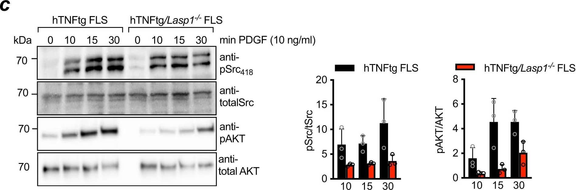 Lasp1 affects tissue architecture in the synovium of hTNFtg mice.a H&E stainings (scale bar: 50 µm) of paraffin sections from hind paws from 12 weeks old wt, Lasp1−/−, hTNFtg and hTNFtg/Lasp1−/− female mice (n = 3 in each group). Evaluation of synovial cell density was performed by counting cell numbers per high power field (HPF, 10.000 µm2) (n = 10, 3 HPF/animal). Data presented as mean ± SEM, *P < 0.05, **P < 0.001, ***P < 0.0001 (two-tailed Mann–Whitney U test). b Immunofluorescence staining for PDPN, FAP alpha , THY1 expression and the nuclei with DAPI in white in 12 weeks old joints (representative images of n = 5 per group, scale bar: 10 µm). c Immunoblotting and quantification for phospho-specific Src kinase (pSrc418) and total Src kinase expression as well as for phospho-specific AKT kinase (pAKT) and total AKT in FLS from hTNFtg and hTNFtg/Lasp1−/− mice stimulated with recombinant murine PDGF for the indicated time periods (n = 3 each group). Source data are provided as a Source Data file. Image collected and cropped by CiteAb from the following publication (//pubmed.ncbi.nlm.nih.gov/34131132), licensed under a CC-BY license. Not internally tested by R&D Systems.