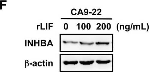 Western Blot Activin A Antibody [Unconjugated] - beta A subunit