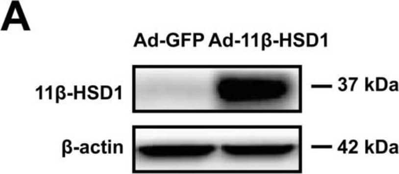 Western Blot 11 beta-HSD1 Antibody
