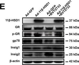 Western Blot 11 beta-HSD1 Antibody