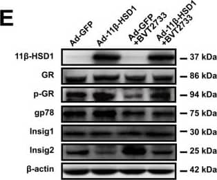 Western Blot 11 beta-HSD1 Antibody