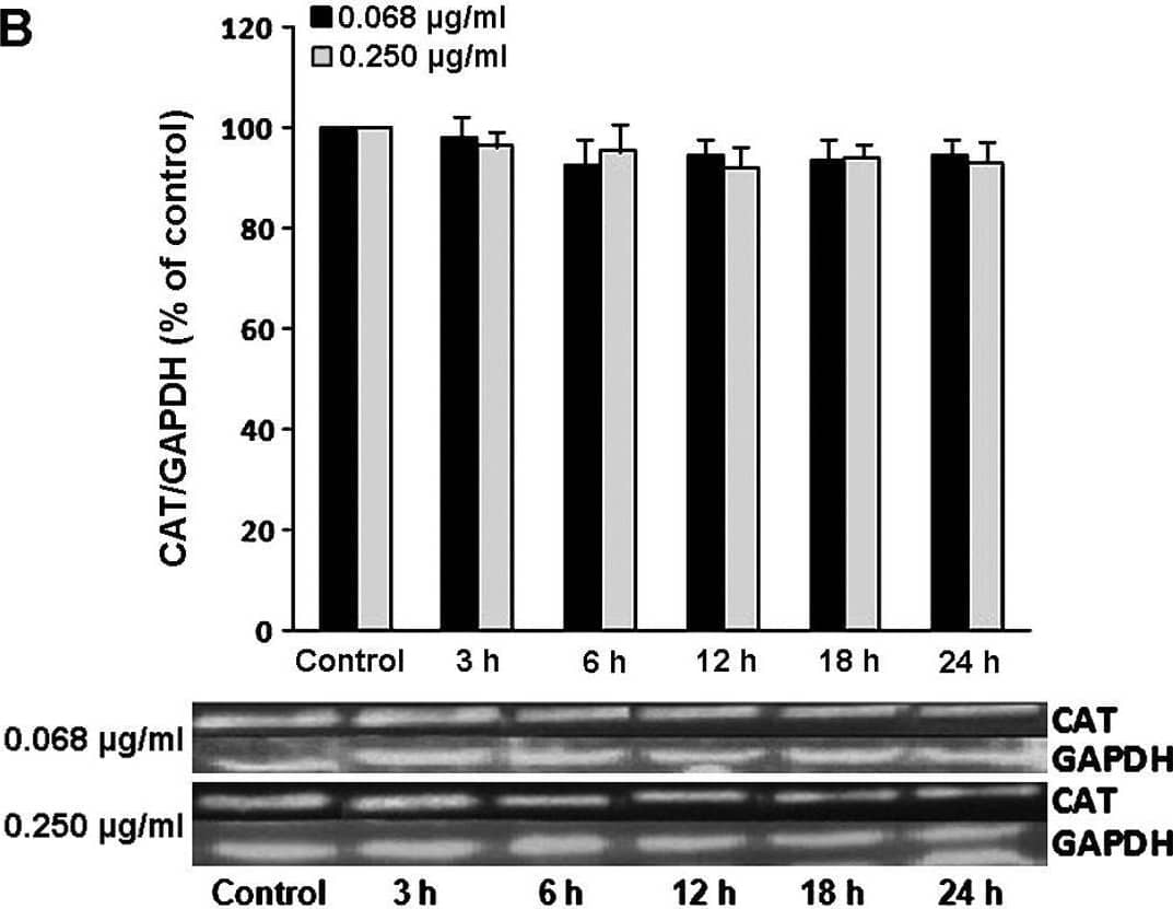 Representative western blots showing the effects of grape pomace extract (GPE) on the expression of (A) gamma-glutamylcysteine synthetase (GCS), (B) catalase (CAT), (C) superoxide dismutase (SOD) and (D) heme oxygenase 1 (HO-1) in EA.hy926 endothelial cells. The results of densitometric quantification for all enzymes are also shown. The cells were incubated with GPE at 0.068 and 0.250 µg/ml for 3, 6, 12, 18 and 24 h. The expression of GAPDH was used as a loading control for normalization. *P<0.05, statistically significant difference compared to the control (untreated cells). The results are presented as the means ± SEM. Image collected and cropped by CiteAb from the following open publication (//pubmed.ncbi.nlm.nih.gov/26082074), licensed under a CC-BY license. Not internally tested by R&D Systems.