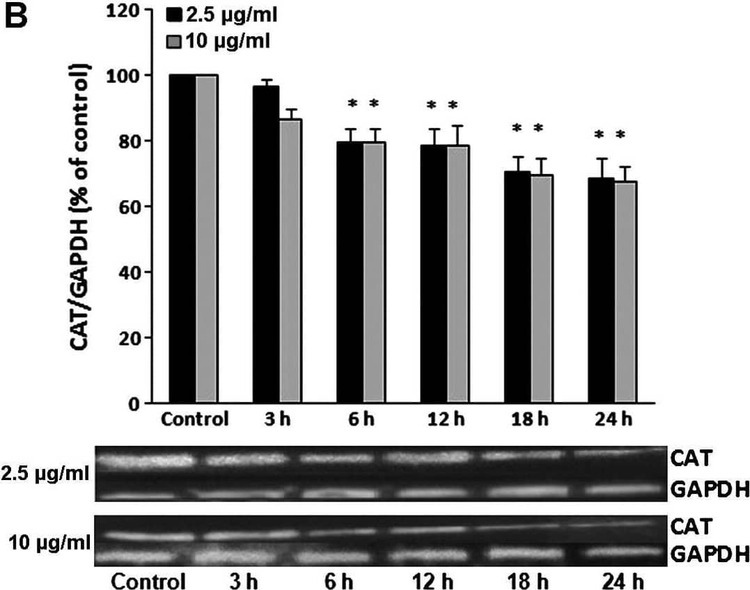Representative western blots showing the effects of grape pomace extract (GPE) on the expression of (A) gamma-glutamylcysteine synthetase (GCS), (B) catalase (CAT), (C) superoxide dismutase (SOD) and (D) heme oxygenase 1 (HO-1) in C2C12 muscle cells. The results of densitometric quantification for all enzymes are also shown. The cells were incubated with GPE at 2.5 and 10 µg/ml for 3, 6, 12, 18 and 24 h. The expression of GAPDH was used as a loading control for normalization. *P<0.05, statistically significant difference compared to the control (untreated cells). The results are presented as the mean ± SEM. Image collected and cropped by CiteAb from the following open publication (//pubmed.ncbi.nlm.nih.gov/26082074), licensed under a CC-BY license. Not internally tested by R&D Systems.