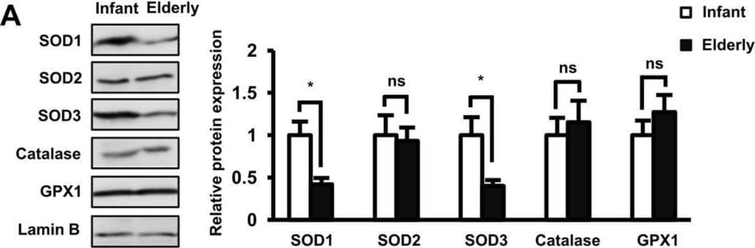 The role of SOD1 and SOD3 antioxidant enzymes in the functions of AT-MSCs. (A) The protein expression of antioxidant enzymes in infant and elderly AT-MSCs. Infant AT-MSCs and elderly AT-MSCs were derived from 5 different donors, respectively (n = 5) and the comparison was conducted with infant AT-MSCs and elderly AT-MSCs at the same passage number. Image collected and cropped by CiteAb from the following open publication (//pubmed.ncbi.nlm.nih.gov/33057147), licensed under a CC-BY license. Not internally tested by R&D Systems.