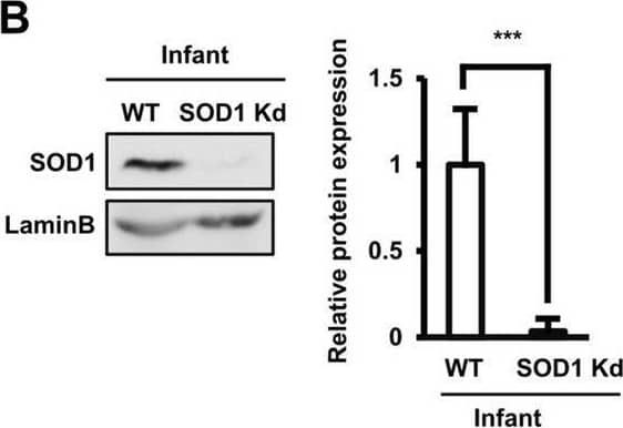 The role of SOD1 and SOD3 antioxidant enzymes in the functions of AT-MSCs.  (B) The protein expression of wild-type and SOD1 knockdown infant AT-MSCs. The knockdown experiments were conducted with infant AT-MSCs from 3 different donors (n = 3). Image collected and cropped by CiteAb from the following open publication (//pubmed.ncbi.nlm.nih.gov/33057147), licensed under a CC-BY license. Not internally tested by R&D Systems.