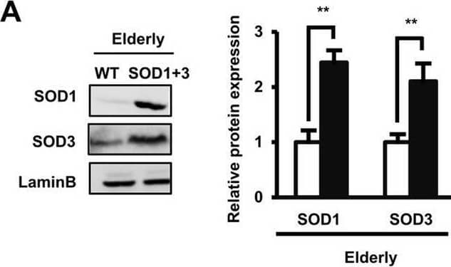 The co-overexpression of SOD1 and SOD3 significantly improved the poor functions of elderly AT-MSCs by the activation of the pERK/ERK pathway. (A) The protein expression of wild-type elderly AT-MSCs or with the co-overexpression of SOD1 and SOD3 (n = 3). (B) The ROS expression in wild-type elderly AT-MSCs or with the co-overexpression of SOD1 and SOD3 (n = 3). (C) The cellular senescence of wild-type elderly AT-MSCs or with the co-overexpression of SOD1 and SOD3 (n = 3). (D) Transplantation of wild-type elderly AT-MSCs or with the co-overexpression of SOD1 and SOD3 to an in vivo streptozotocin-induced diabetic ischemic flap mouse model (n = 3). (E) The protein expression of pERK/ERK in infant AT-MSC, wildtype elderly AT-MSCs, elderly AT-MSCs with the individual overexpression of SOD1 or SOD3 or elderly AT-MSCs with the co-overexpression of SOD1 and SOD3 (n = 3). (F) The protein expression of pERK/ERK under the presence of a MEK inhibitor (n = 3). (G) The mRNA expression of wound healing-related growth factors in elderly AT-MSCs with the co-overexpression of SOD1 and SOD3 under the presence of a MEK inhibitor (n = 3). (H) Transplantation of elderly AT-MSCs with the co-overexpression of SOD1 and SOD3 under the presence of a MEK inhibitor to an in vivo streptozotocin-induced diabetic ischemic flap mouse model (n = 3). In all above experiments, elderly AT-MSCs were derived from 3 different donors (n = 3). SOD1 + 3: elderly AT-MSCs with co-overexpression of SOD1 and SOD3. PD098059 (PD) was used as a MEK inhibitor. The data represent the mean ± SD. ***P < 0.001, **P < 0.01, *P < 0.05, ns no significance. The experiments were performed in triplicate. Full-length Western blots are presented in Supplementary Figure S4. Image collected and cropped by CiteAb from the following open publication (//pubmed.ncbi.nlm.nih.gov/33057147), licensed under a CC-BY license. Not internally tested by R&D Systems.