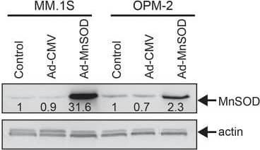 CD138low cells have altered mitochondrial properties that can be utilized to induce oxidative stress by 10-TPP treatment E. HMCLs transduced with Ad-CMV or Ad-MnSOD, treated with 10-TPP,&MitoSOX oxidation was analyzed by flow cytometry. Data is presented as fold change normalized to control cells expressing Ad-CMV. Antimycin A treatment was used as a positive control. *p < 0.01 vs. control cells (Ad-CMV or Ad-MnSOD), #p < 0.05 vs. 10-TPP treated Ad-CMV cells. Representative WB of HMCLs transduced with Ad-CMV or Ad-MnSOD (MOI = 50), whole-cell extract was made at 48 h&probed with an antibody against MnSOD (24 kDa) or  beta -actin. The quantification of MnSOD after normalization to untreated control is shown below each band. F. Structure of 10-TPVP; representative confocal images of MM.1S&OPM-2 cells stained with MitoTracker red&10-TPVP. The bright field view&merge image of MitoTracker Red&10-TPVP are also shown. For panels B-E, bars represent mean of three independent runs ± SEM. Image collected & cropped by CiteAb from the following open publication (//pubmed.ncbi.nlm.nih.gov/27902770), licensed under a CC-BY license. Not internally tested by R&D Systems.