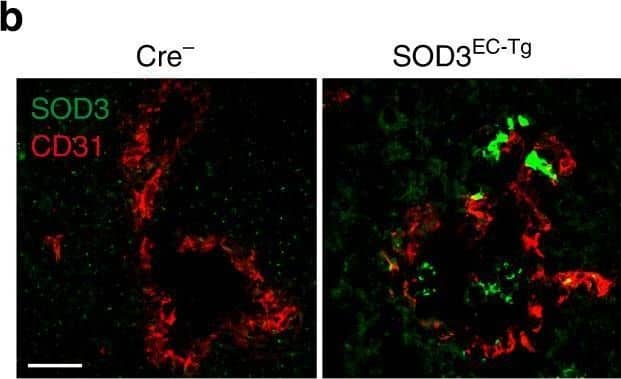 EC-specific SOD3 expression is sufficient to increase Doxo effect. a Conditional expression allele for the SOD3-IRES-GFP gene at the ROSA26 locus. b SOD3 (green) and CD31 (red) detection in sections from tumors grown in Cre-expressing and Cre− mice after tamoxifen induction. c LLC tumor growth kinetics in SOD3EC-Tg and control (Cre−) mice. Arrows indicate tamoxifen and Doxo treatments (n = 10/group). d Doxo quantification in extracts of tumors dissected at day 16 from control and SOD3EC-Tg mice (n = 15 or 17 mice/group). e, f Images and quantification of lectin-FITC-perfused and CD31-stained vessels in control and SOD3EC-Tg tumors (0.7–1.2 cm3) dissected at day 20. g CD31 staining of control and SOD3EC-Tg tumors at end point. h–l CD31+ structure density (h), mean area covered by CD31+ structures (i), mean vessel length (j) and diameter (k), and the number of vessel branches (l), determined in images as in g. m CD31 (green) and VEC (red) staining of tumors grafted in SOD3EC-Tg and control mice. Bottom panels show red staining in a magnified area. n Quantification of the VEC area in CD31+ structures from images as in m. o Vessel permeability determined by FITC-lectin and Texas Red-dextran in tumors dissected at day 17 from control and SOD3EC-Tg mice. For b, e–o, 10–20 images were analyzed from 5 mice/group; *p < 0.05, **p < 0.01, two-tailed Student’s t-test. Bar, 50 μm Image collected and cropped by CiteAb from the following open publication (//pubmed.ncbi.nlm.nih.gov/29422508), licensed under a CC-BY license. Not internally tested by R&D Systems.