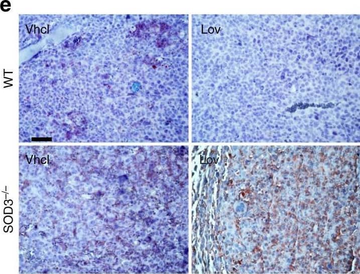 SOD3 upregulation enhances Doxo chemotherapeutic effects. a, b LLC tumor growth kinetics in Vhcl-, Lov-, Doxo+Vhcl-, or Doxo+Lov-treated WT (a) and SOD3−/− mice (b). Arrows indicate treatment schedule (n = 10 mice/group). c Tumors from WT or SOD3−/− mice treated as above were dissected on day 16 and Doxo was quantified in tumor extracts. d Vhcl- and Lov-treated tumors from WT or SOD3−/− mice were dissected on day 18 (<1 cm3), and SOD3 and CD31 were detected in cryosections by immunohistochemistry (IHC); the two-color merge is shown (n = 10 fields/group; 4 mice/group). e 3-NT detection in paraffin sections of LLC tumors as in d (n = 15 fields/group; 4 mice/group). f LLC-GFP cells were implanted in WT or SOD3−/− mice, Lov-treated as in a, and tumors were dissected on day 21. LLC cells, ECs, and leukocytes were isolated by cell sorting and SOD3 mRNA was determined by qPCR. Data shown as mean ± SEM of triplicates (n = 5 mice/group). g Detection of SOD3 expression (red) and CD31 (green) in sections of Ad-C- or Ad-mSOD3-injected LLC tumors (dissected on day 18); nuclei are DAPI-stained (blue). Arrows in the SOD3 panel indicate the position of CD31+ cells. Bottom panel shows SOD3 fluorescence intensity quantified by ImageJ (15 images/group; 4 mice/group). h Growth kinetics of Ad-C- or Ad-mSOD3-injected LLC tumors. Arrows indicate treatment schedule (n = 9 mice/group). i Doxo quantification in extracts of tumors dissected on day 16 from mice treated as in h. *p < 0.05, **p < 0.01, ***p < 0.001 one-way ANOVA with Dunnett’s post-hoc test using Vhcl group as reference (a, b) or two-tailed Student’s t-test (f–i). Bar, 10 μm (d, g) and 50 μm (e) Image collected and cropped by CiteAb from the following open publication (//pubmed.ncbi.nlm.nih.gov/29422508), licensed under a CC-BY license. Not internally tested by R&D Systems.