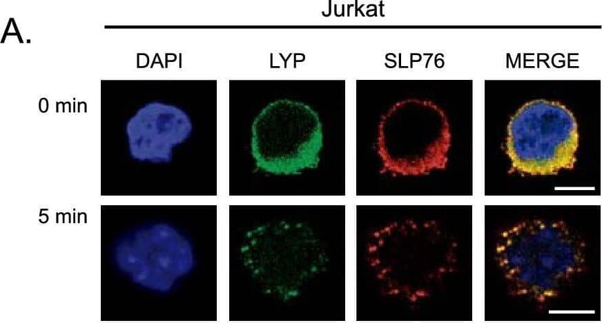 LYP co-localizes with SLP76 in T cell microclusters. Jurkat cells (A) or PBL (B) were plated on coverslips covered with antibody for CD3 for the indicated periods of time. Then, cells were fixed and stained with specific antibodies for SLP76 and LYP, as indicated. Images were taken with a confocal microscope and representative images are shown. C, Wild type and 494 Jurkat cell lines were plated on coverslips covered with CD3 antibody for the indicated periods of time. Then, cells were fixed and stained with specific antibodies for SLP76. D, PBL cells were left untreated or stimulated with PHA for 72 h to induce the expression of LYP. As before, they were plated on stimulatory coverslips and processed to detect LYP and SLP76 by immunofluorescence with a confocal microscope. E, LYP expression in PLB treated with PHA. Scale bar represents 5 μm Image collected and cropped by CiteAb from the following open publication (//pubmed.ncbi.nlm.nih.gov/39342392), licensed under a CC-BY license. Not internally tested by R&D Systems.