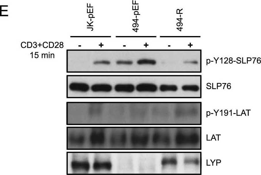 Regulation of TCR signaling by LYP downstream of ZAP70. A Activation of a luciferase reporter gene driven by the IL-2 minimal promoter in Jurkat cells transfected with Vav and stimulated with CD3 plus CD28 antibodies for 6 h, as indicated. The insert shows the IB of the Vav and LYP proteins expressed. *P < 0.05 and **P < 0.01 for comparison of cells transfected with different plasmids and cells transfected with empty vector (pEF). B Activation of a luciferase reporter gene driven by the IL-2 minimal promoter in Jurkat cells transfected with rac-QL, a dominant active mutant of rac, and LYP and and stimulated with CD3 plus CD28 antibodies for 6 h. The insert shows the IB of LYP. *P < 0.05 and **P < 0.01 for comparison of cells transfected with different plasmids and cells transfected with empty vector (pEF) C Activation of a luciferase reporter gene driven by the IL-2 minimal promoter in wild type and 494 Jurkat cells transfected with LYP and SLP76 as indicated. The cells were left untreated or stimulated with CD3/CD28 antibodies for for 6 h. The insert shows the IB of the SLP76 and LYP proteins expressed. *P < 0.05 **P < 0.01 and ***P < 0.001 for comparison of cells transfected with different plasmids and cells transfected with empty vector (pEF). D Wild type and 494 JK cells were stimulated with CD3/CD28 antibodies during the indicated periods of time. Phosphorylation of Y128 of SLP76 in each condition was measured in cell lysates by IB. Similarly, phosphorylation of LCK in Y394 and Y493 are shown. E, Wild type Jurkat cells and cells deficient in LYP (JK 494) transfected with LYP were stimulated with CD3/CD28 antibodies for 15 min and the phosphorylation of Y128 of SLP76, and Y191 of LAT were detected in each condition by IB Image collected and cropped by CiteAb from the following open publication (//pubmed.ncbi.nlm.nih.gov/39342392), licensed under a CC-BY license. Not internally tested by R&D Systems.