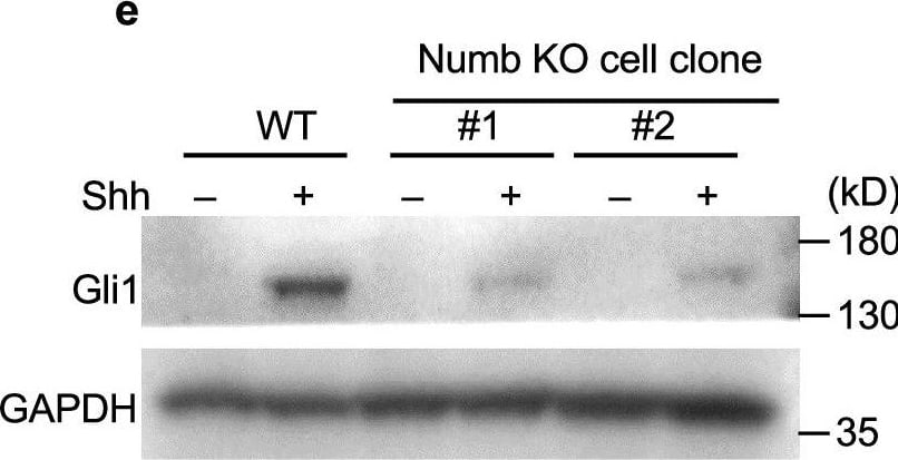 Western Blot GLI-1 Antibody [Unconjugated]