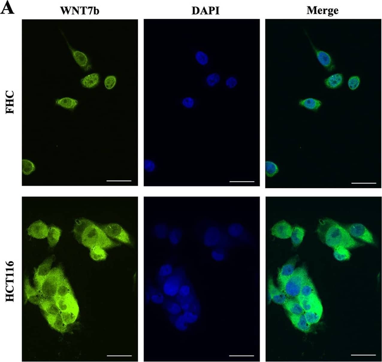 Immunocytochemistry/ Immunofluorescence Wnt-7b Antibody [Unconjugated]