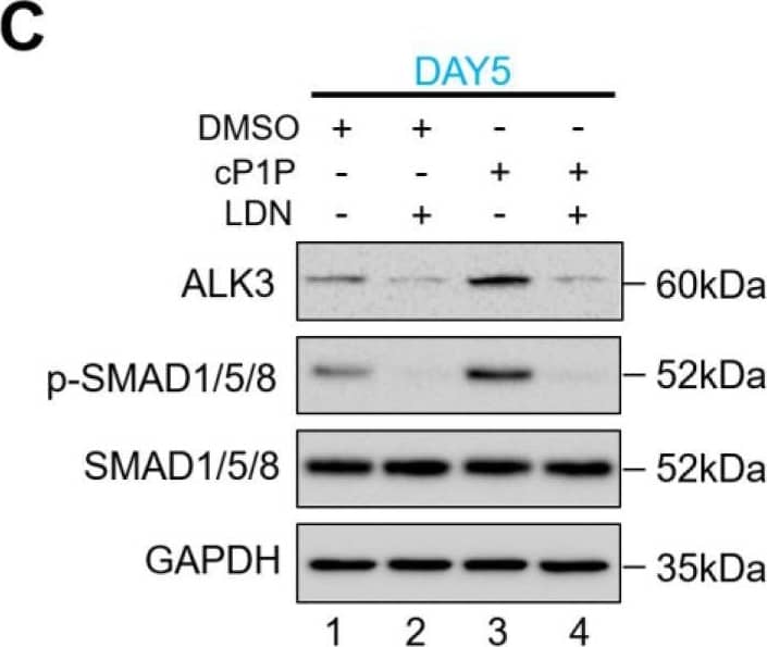 Western Blot BMPR-IA/ALK-3 Antibody [Unconjugated]