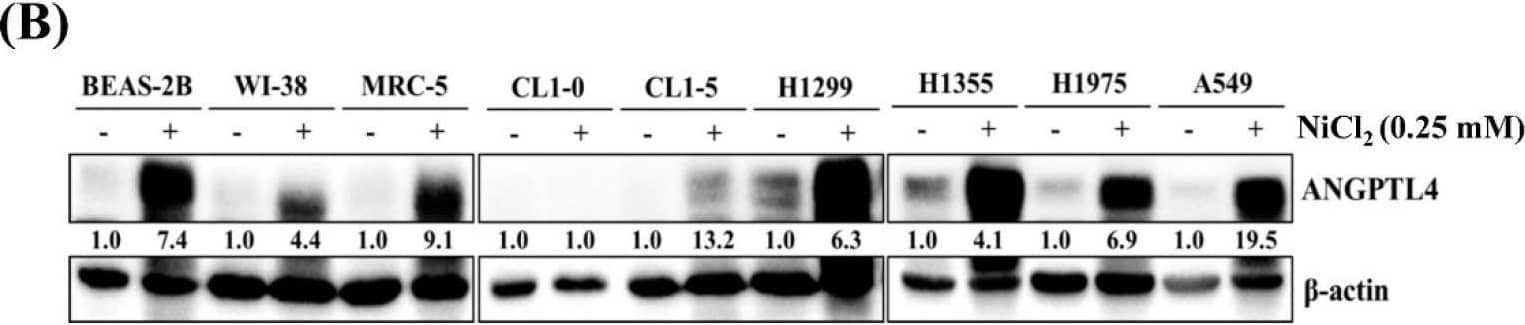Western Blot Angiopoietin-like Protein 4/ANGPTL4 Antibody [Unconjugated]