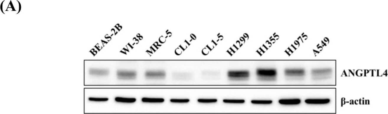Western Blot Angiopoietin-like Protein 4/ANGPTL4 Antibody [Unconjugated]