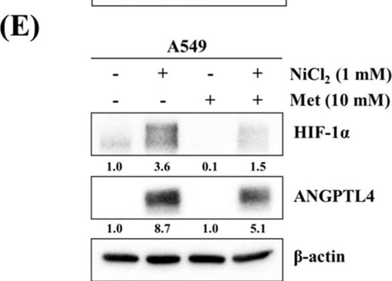 Western Blot Angiopoietin-like Protein 4/ANGPTL4 Antibody [Unconjugated]