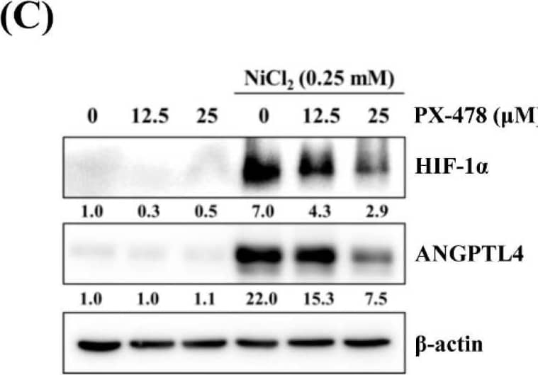 Western Blot Angiopoietin-like Protein 4/ANGPTL4 Antibody [Unconjugated]