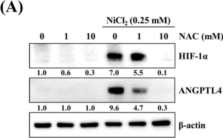 Western Blot Angiopoietin-like Protein 4/ANGPTL4 Antibody [Unconjugated]