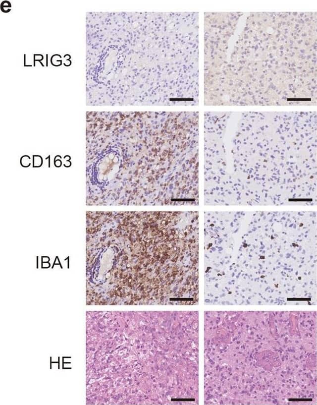 LRIG3 expression is negatively correlated with tumor-supportive TAMs in human GBM and informs good prognosis of GBM patients. A, b The stroma score (a) and immune score (b) of LRIG3-High-expression and LRIG3-low-expression patients in the TCGA GBM database. The stroma and immune scores were determined based on expression data (Yoshihara et al., 2013). Unpaired student’s t test. c GSEA analysis based on KEGG gene sets and TCGA GBM database. d GSEA analysis for various types of immune cells in LRIG3-High-expression and LRIG3-low-expression patients in TCGA GBM database. e Representative images of HE staining and the low- and high-expression levels of LRIG3, CD163, and IBA1 in human GBM tissue microarrays. Scale bar, 50 mm. f, g Correlation analysis between LRIG3 and CD163 expression in TMA of low grade (grade 2 and 3) glioma (n = 31) (f) and GBM (n = 40) (g). Pearson’s correlation test. h Kaplan–Meier survival curves of LRIG3-High-expression and LRIG3-Low-expression patients in TCGA GBM database. Image collected and cropped by CiteAb from the following open publication (//pubmed.ncbi.nlm.nih.gov/36639372), licensed under a CC-BY license. Not internally tested by R&D Systems.