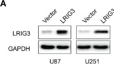 Ectopic expression of LRIG3 reduces the pro-angiogenic activity of glioma cells in vitro.(A) Western blots showing levels of LRIG3 expression in the vector control and LRIG3-transduced glioma cells. GAPDH was used as an internal control. (B) Representative images (left) and quantification (right) of wound healing assays in HUVECs treated with CM derived from the vector control or LRIG3-transduced glioma cells. (C) Representative images (left) and quantification (right) of transwell migration assays of HUVECs treated with the indicated CM. (D) Representative images (left) and quantification (right) of HUVECs formed tube-like structures on Matrigel-coated plates with CM derived from the vector control or LRIG3-transduced glioma cells. (E) HUVEC viability was determined using the MTT assay. HUVECs were treated with CM derived from the indicated cells for the specific number of days. Data are means ± SD of 3 replicates. *p < 0.05; **p < 0.01; ***p < 0.001. CM, conditioned medium. Image collected and cropped by CiteAb from the following open publication (//pubmed.ncbi.nlm.nih.gov/33718179), licensed under a CC-BY license. Not internally tested by R&D Systems.