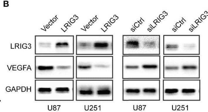 LRIG3 inhibited glioma angiogenesis by regulating VEGFA expression. (A) qRT-PCR analysis targeting angiogenic factors in glioma cells transduced with LRIG3 and control siRNAs. (B) Western blot analysis of VEGFA, LRIG3, and GAPDH. (C) Integrated density of the bands was normalized to GAPDH in LRIG3 knockdown or overexpression glioma cells. (D) Levels of VEGFA protein in the CM from glioma cells with LRIG3 knockdown or overexpression were detected by ELISA. Data are means ± SD of 3 independent replicates. *p < 0.05; **p < 0.01; ***p < 0.001. CM, conditioned medium. Image collected and cropped by CiteAb from the following open publication (//pubmed.ncbi.nlm.nih.gov/33718179), licensed under a CC-BY license. Not internally tested by R&D Systems.