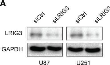 Downregulation of LRIG3 enhances the pro-angiogenic activity of glioma cells in vitro. (A) Western blot analysis of LRIG3 expression in the siRNA control and LRIG3-silenced glioma cells. GAPDH was used as an internal control. (B) Representative images (left) and quantification (right) of wound healing assays of HUVECs treated with CM derived from the siRNA control or LRIG3-silenced glioma cells. (C) Representative images (left) and quantification (right) of transwell migration assays in HUVECs treated with the indicated CM. (D) Representative images (left) and quantification (right) of HUVECs formed tube-like structures on Matrigel-coated plates with CM derived from the siRNA control cells or LRIG3-silenced glioma cells. (E) HUVEC viability was determined using the MTT assay. HUVECs were treated with CM derived from the indicated cells for the specific number of days. Data are presented as means ± SD of 3 independent replicates. *p < 0.05; **p < 0.01. CM, conditioned medium. Image collected and cropped by CiteAb from the following open publication (//pubmed.ncbi.nlm.nih.gov/33718179), licensed under a CC-BY license. Not internally tested by R&D Systems.