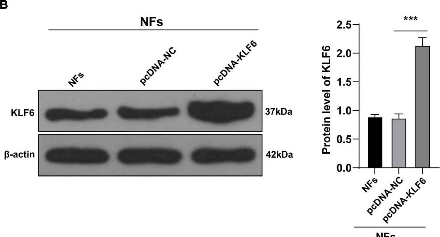 Overexpression of KLF6 attenuated EVs-induced activation of CAFs. NFs were co-treated with A2780 or SKOV3 cells-derived EVs and KLF6 pcDNA or its NC. (A,B) Transfection efficiency of KLF6 pcDNA was confirmed using RT-qPCR and Western blotting; (C,D) levels of CAFs marker proteins ( alpha -SMA and FAP) in NFs were detected using RT-qPCR and Western blotting. (E) Migration of NFs in each group was detected using Transwell assay; the migrated cells were counted and representative images were displayed. The experiment was repeated three times independently. Data are presented as mean ± standard deviation and analyzed using one-way ANOVA, followed by Tukey’s multiple comparison test, **p < 0.01, ***p < 0.001. A2780 and SKOV3 in the panels (C,D) indicated the source of EVs. Image collected and cropped by CiteAb from the following open publication (//pubmed.ncbi.nlm.nih.gov/34277601), licensed under a CC-BY license. Not internally tested by R&D Systems.