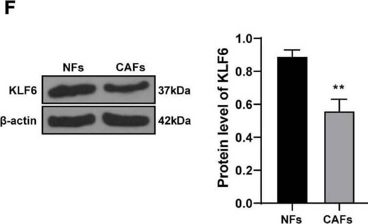 miR-630 targeted KLF6. (A) Target genes of miR-630 were predicted through TargetScan7, RNAInter (Score > 0.70), and miRDB (Score > 70) databases; (B) binding site between miR-630 and KLF6 was predicted through databases; (C) targeting relationship between miR-630 and KLF6 was verified using dual-luciferase reporter gene assay; (D) RIP assay verified the interaction between miR-630 and KLF6 mRNA; (E,F) KLF6 expression in cells in each group was detected using RT-qPCR and Western blotting; (G–J) KLF6 expression in NFs after different treatments was detected using RT-qPCR and Western blotting. The experiment was repeated three times independently. Data are presented as mean ± standard deviation. Data in panel (C–F) were analyzed using t-test, and data in panels (G–J) were analyzed using one-way ANOVA, followed by Tukey’s multiple comparison test, **p < 0.01, ***p < 0.001. A2780 and SKOV3 in panels (I,J) indicated the source of EVs. Image collected and cropped by CiteAb from the following open publication (//pubmed.ncbi.nlm.nih.gov/34277601), licensed under a CC-BY license. Not internally tested by R&D Systems.