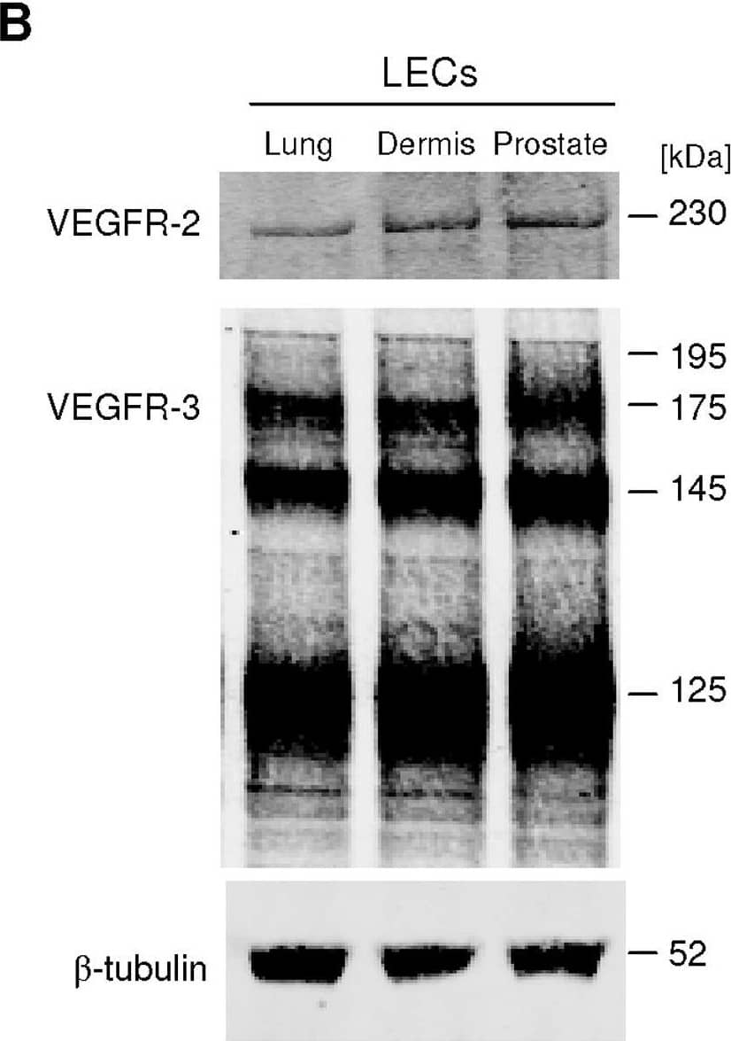 VEGF-C induces LEC tube formation.A, Prostatic LEC tube length at 4.5 hours post VEGF-C treatment was quantified using ImageJ. VEGF-C significantly increased the number of tubes formed compared to vehicle control. Data expressed as mean±s.e.m., n = 3, ***P<0.001 using One-way ANOVA, Bonferroni post-analysis. B, Western blotting analysis of VEGFR-2 and VEGFR-3 expression in lung, neonatal dermis and prostate LECs.  beta -tubulin was used as a loading control. Image collected and cropped by CiteAb from the following open publication (//pubmed.ncbi.nlm.nih.gov/22745786), licensed under a CC-BY license. Not internally tested by R&D Systems.