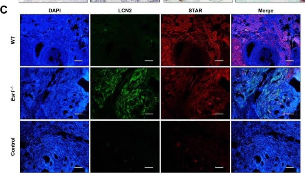 Increased LCN2 expression in Esr1-deficient ovaries. Ovaries from wild-type (WT, n = 8) and Esr1 null mice (n = 6) were dissected and either embedded in paraffin or prepared for RNA analysis. (A) Hematoxylin and eosin (H & E) staining showed characteristic histological changes in Esr1-deficient compared to WT ovaries. (B) Immunohistochemical staining for LCN2 and ER alpha  was performed. Sections were counterstained with hematoxylin (LCN2) or methyl green (ER alpha ). Magnifications: 100×, 400×; scale bars: 100 µm, 50 µm. (C) Tissue samples were subjected to immunofluorescence double staining for LCN2 and STAR. Magnifications: 100×; scale bars: 100 µm. (D) Lcn2 and Star expression was analyzed in ovarian tissues using RT-qPCR. Data are displayed as means ± SD. In case of normal distribution, Student’s t-tests were chosen for statistical analysis, otherwise a Mann–Whitney test was performed. Significant differences between groups are marked with asterisks: *** p < 0.001. Image collected and cropped by CiteAb from the following open publication (//pubmed.ncbi.nlm.nih.gov/37298232), licensed under a CC-BY license. Not internally tested by R&D Systems.