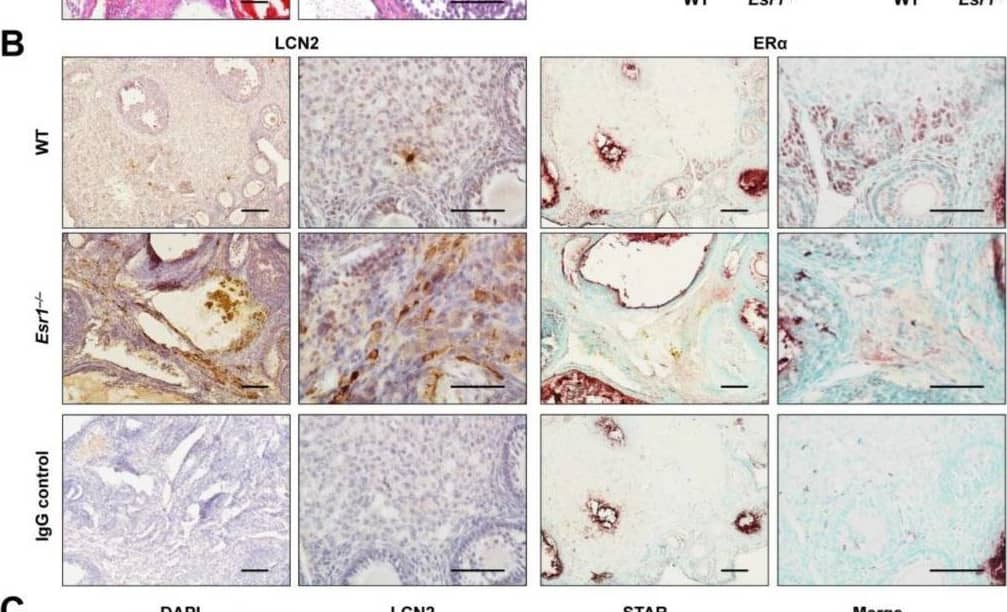 Increased LCN2 expression in Esr1-deficient ovaries. Ovaries from wild-type (WT, n = 8) and Esr1 null mice (n = 6) were dissected and either embedded in paraffin or prepared for RNA analysis. (A) Hematoxylin and eosin (H & E) staining showed characteristic histological changes in Esr1-deficient compared to WT ovaries. (B) Immunohistochemical staining for LCN2 and ER alpha  was performed. Sections were counterstained with hematoxylin (LCN2) or methyl green (ER alpha ). Magnifications: 100×, 400×; scale bars: 100 µm, 50 µm. (C) Tissue samples were subjected to immunofluorescence double staining for LCN2 and STAR. Magnifications: 100×; scale bars: 100 µm. (D) Lcn2 and Star expression was analyzed in ovarian tissues using RT-qPCR. Data are displayed as means ± SD. In case of normal distribution, Student’s t-tests were chosen for statistical analysis, otherwise a Mann–Whitney test was performed. Significant differences between groups are marked with asterisks: *** p < 0.001. Image collected and cropped by CiteAb from the following open publication (//pubmed.ncbi.nlm.nih.gov/37298232), licensed under a CC-BY license. Not internally tested by R&D Systems.