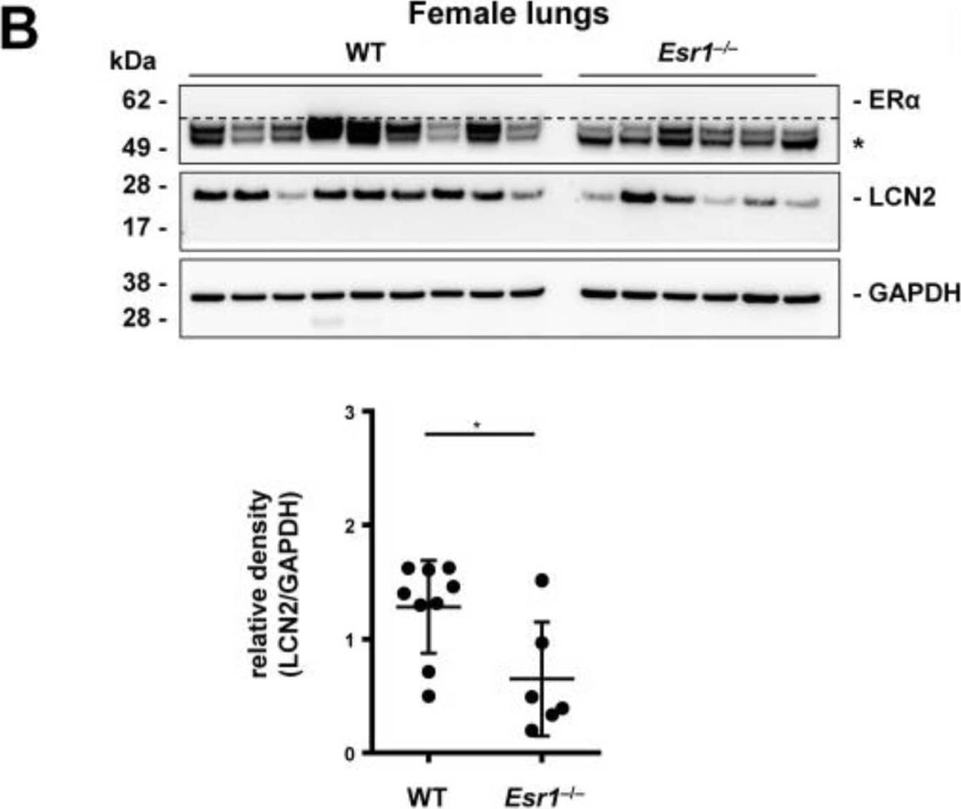 LCN2 and ER alpha  expression in the lung and kidney. Tissues from wild-type (WT, female: n = 9, male: n = 8) and Esr1 knockout (female: n = 6, male: n = 8) mice were either embedded in paraffin for immunostaining or processed for protein analysis. Immunohistochemistry staining was performed to localize LCN2 expression in (A) lung and (C) kidney tissue. Isotope-specific negative control IgG staining was performed to document antibody specificity. Magnifications: 100×; scale bar: 100 µm. LCN2 and ER alpha  protein expression was analyzed in (B) lung and (D) kidney tissues by Western blot analysis in WT and Esr1 null mice. The expression of GAPDH (lungs) and vinculin (kidneys) was used to demonstrate equal protein loading. Unspecific bands are marked with asterisks (*) and are separated from specific bands by dashed lines. Protein expression of LCN2 was quantified densitometrically and plotted relative to the expression of the loading control. Mann–Whitney test (lungs) or Student’s t-tests (kidney) was used for statistical analysis. Significant differences between groups are indicated with asterisks: * p < 0.05. Data are displayed as means ± SD and non-significant results are marked with ns. Image collected and cropped by CiteAb from the following open publication (//pubmed.ncbi.nlm.nih.gov/37298232), licensed under a CC-BY license. Not internally tested by R&D Systems.