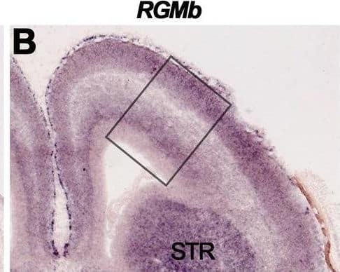 RGMa, RGMb and Neogenin display partially complementary patterns of expression in the developing cortex and on cortical projections.In situ hybridization (A–C′) and immunohistochemistry (D–L) on coronal mouse brain sections at E16.5. Panels A′–C′ and D′–F′ show higher magnifications of the boxed areas in A–C and D–F, respectively. Sections in D–L are counterstained in blue with fluorescent Nissl. (A–C′) In situ hybridization reveals strong expression of RGMa and Neogenin, and moderate expression of RGMb, in the embryonic mouse cortex. Arrow in A indicates neurons of the lateral migratory stream. (D–I) RGMa and Neogenin protein are strongly expressed in the cortex and on various cortical axon projections. Strong staining for RGMb (E), and Neogenin (F), is detected in the corpus callosum (CC). The internal capsule (IC) stains strongly for RGMa (G). (J–L) Immunostaining with isotype-matched control antibodies did show significant staining. CP, cortical plate; FIM, fimbria; IZ, intermediate zone; LV, lateral ventricle; MZ, marginal zone; SP, subplate; STR, striatum; SVZ, subventricular zone; VZ, ventricular zone. Scale bar A–C 400 µm, A′–C′ 200 µm, D–F 300 µm, D′–F′ 150 µm, G-I 300 µm and J-M 300 µm. Image collected and cropped by CiteAb from the following open publication (//pubmed.ncbi.nlm.nih.gov/23457482), licensed under a CC-BY license. Not internally tested by R&D Systems.