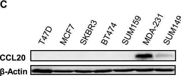 CCL20 promoted tumor progression and enhanced the chemoresistance to taxanes in TNBC.(B-C) CCL20 levels determined by qRT-PCR or western blot in 7 breast cancer cell lines. Image collected and cropped by CiteAb from the following open publication (//pubmed.ncbi.nlm.nih.gov/30052635), licensed under a CC-BY license. Not internally tested by R&D Systems.