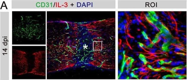 IL‐3 is specifically expressed in astrocytes at 14 dpi. (A) Immunofluorescent staining of CD31 (green), IL‐3 (red), and nuclei (blue) in sagittal sections at 14 dpi. (B) Immunofluorescent staining of PDGFR beta  (green), IL‐3 (red), and nuclei (blue) in sagittal sections at 14 dpi. (C) Immunofluorescent staining of CD68 (green), IL‐3 (red), and nuclei (blue) in sagittal sections at 14 dpi. (D) Immunofluorescent staining of NG2 (green), IL‐3 (red), and nuclei (blue) in sagittal sections at 14 dpi. (E) Immunofluorescent staining of GFAP (green), IL‐3 (red), and nuclei (blue) in sagittal sections at 14 dpi. The region of interest (ROI) represents the boxed region on the left. Asterisks indicate the injured core. Scale bars: 200 μm (left panel) and 20 μm (right panel). n = 3 animals per group. (F) Quantification of the proportion of IL‐3+CD31+ cells in CD31+ cells, IL‐3+PDGFR beta + cells in PDGFR beta + cells, IL‐3+CD68+ cells in CD68+ cells, IL‐3+NG2+ cells in NG2+ cells, or IL‐3+GFAP+ cells in GFAP+ cells at 14 dpi. ND, no determined, **p < 0.01; ****p < 0.001 by one‐way ANOVA followed by Tukey's post hoc test. Image collected and cropped by CiteAb from the following open publication (//pubmed.ncbi.nlm.nih.gov/39697159), licensed under a CC-BY license. Not internally tested by R&D Systems.