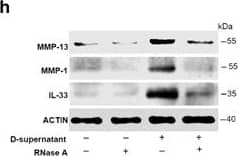RNAs released from injured osteoarthritic cartilages induce IL-33 expression in normal human chondrocytes. (a) TUNEL immunofluorescent staining in normal and osteoarthritic cartilage tissue slices. Scale bar represents 50 μm. (b) Western blot analysis of cleaved caspase-3 in normal and osteoarthritic cartilages. Samples from four OA patients were pooled together. (c) Western blot for IL-33, MMP-1, MMP-13, and type II collagen expression in normal human chondrocytes treated with the supernatants of osteoarthritic cartilage tissue homogenates. D-supernatant represents supernatant from damaged cartilage lysate. (d–g) Quantification of Il-33 (d), Mmp-1 (e), and Mmp-13 (f) and collagen II (g) expression in normal human chondrocytes induced by the supernatant of damaged cartilage lysate at different time points. (h) Western blot analysis for IL-33, MMP-1, and MMP-13 induced by the supernatant of osteoarthritic cartilage tissue homogenates in human chondrocytes pretreated with or without 5 μg/ml RNase A. D-supernatant represents supernatant from damaged cartilage lysate. (i–k) Quantification of Il-33 (i), Mmp-1 (j), and Mmp-13 (k) expression in normal human chondrocytes induced by the supernatant of osteoarthritic cartilage tissue homogenates in human chondrocytes pretreated with or without 5 μg/ml RNase A. D-supernatant represents supernatant from damaged cartilage lysate. **P<0.01 and ***P<0.001. P-values were analyzed by one-way ANOVA Image collected and cropped by CiteAb from the following open publication (//pubmed.ncbi.nlm.nih.gov/29095435), licensed under a CC-BY license. Not internally tested by R&D Systems.